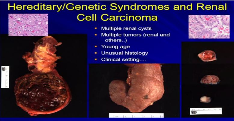 Path 21 Hereditary Genetic