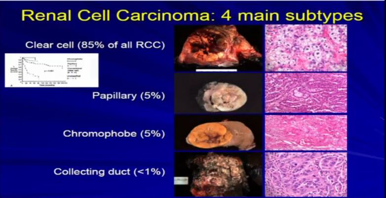 Path 8 RCC Most types