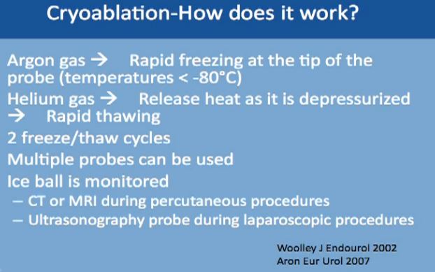 10Cryoablation How