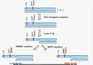 BRUG 10 VHL mutat high low grade diff