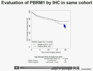 BRUG 16Evalu of PBRM1 by IHC cohort