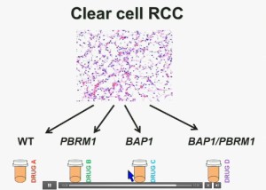 BRUG 21ccRCC per genes